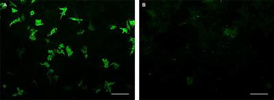 A novel cell-based immunofluorescence assay for the detection of autoantibodies to myelin-associated glycoprotein